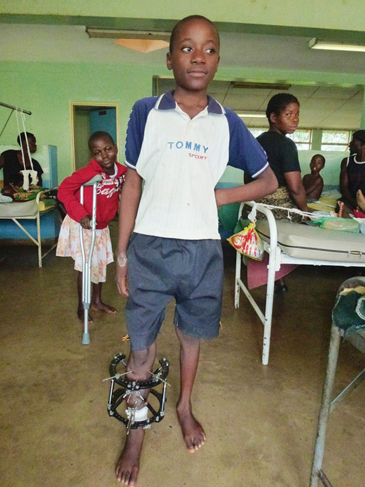 Children being treated by Malawian surgeons
